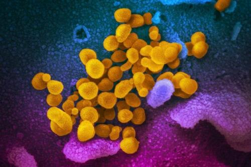 COVID-19 Pandemic Accelerated Brain Aging Even I People Who Didn't Get Virus: Study
